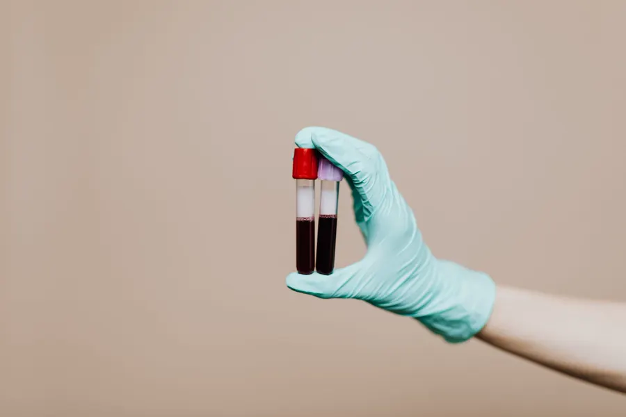 A gloved hand holding two blood sample tubes